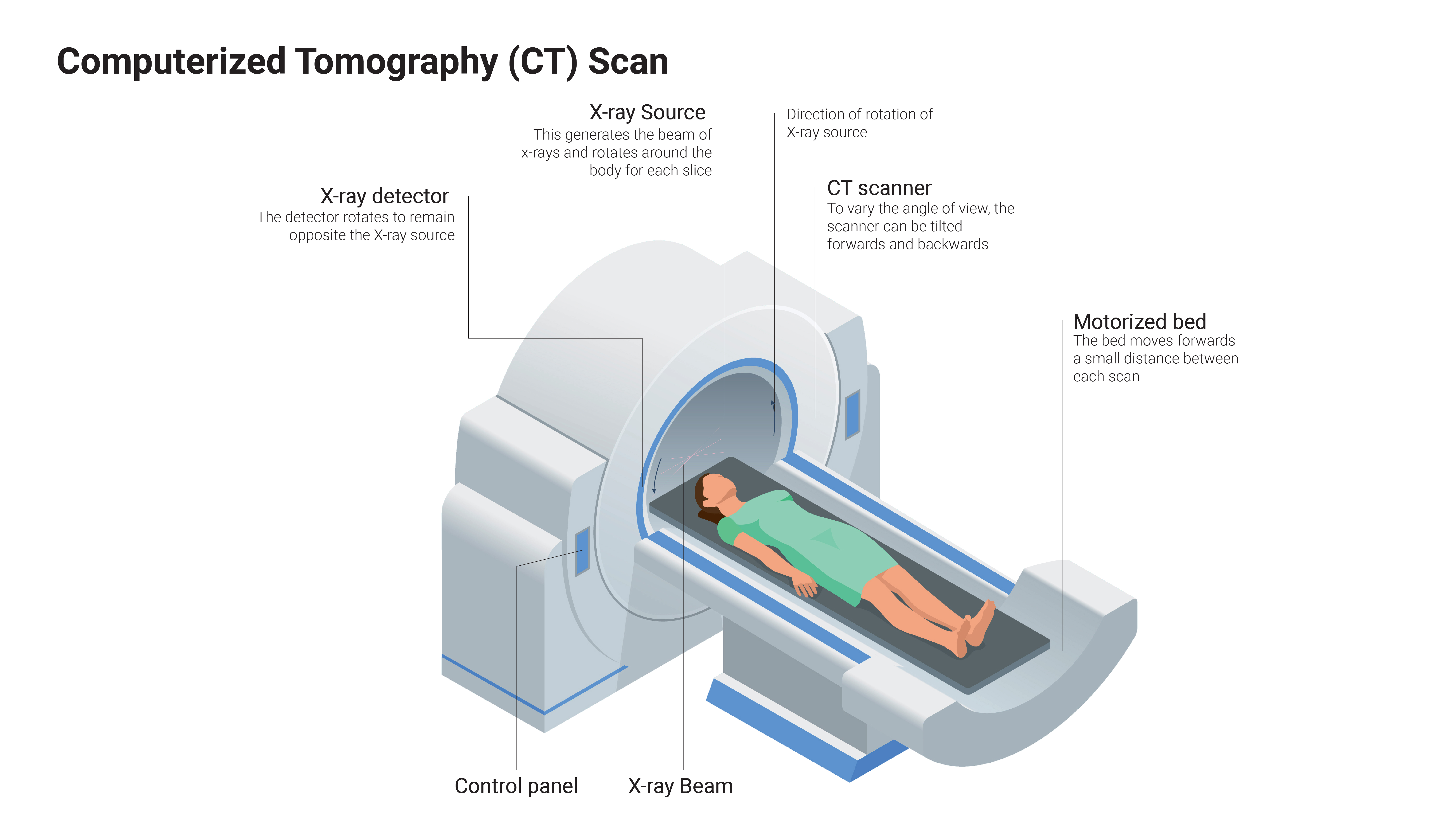 Computerized Tomography Ct Scan Gi Update