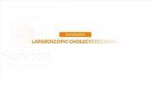 Laparoscopic Cholecystectomy